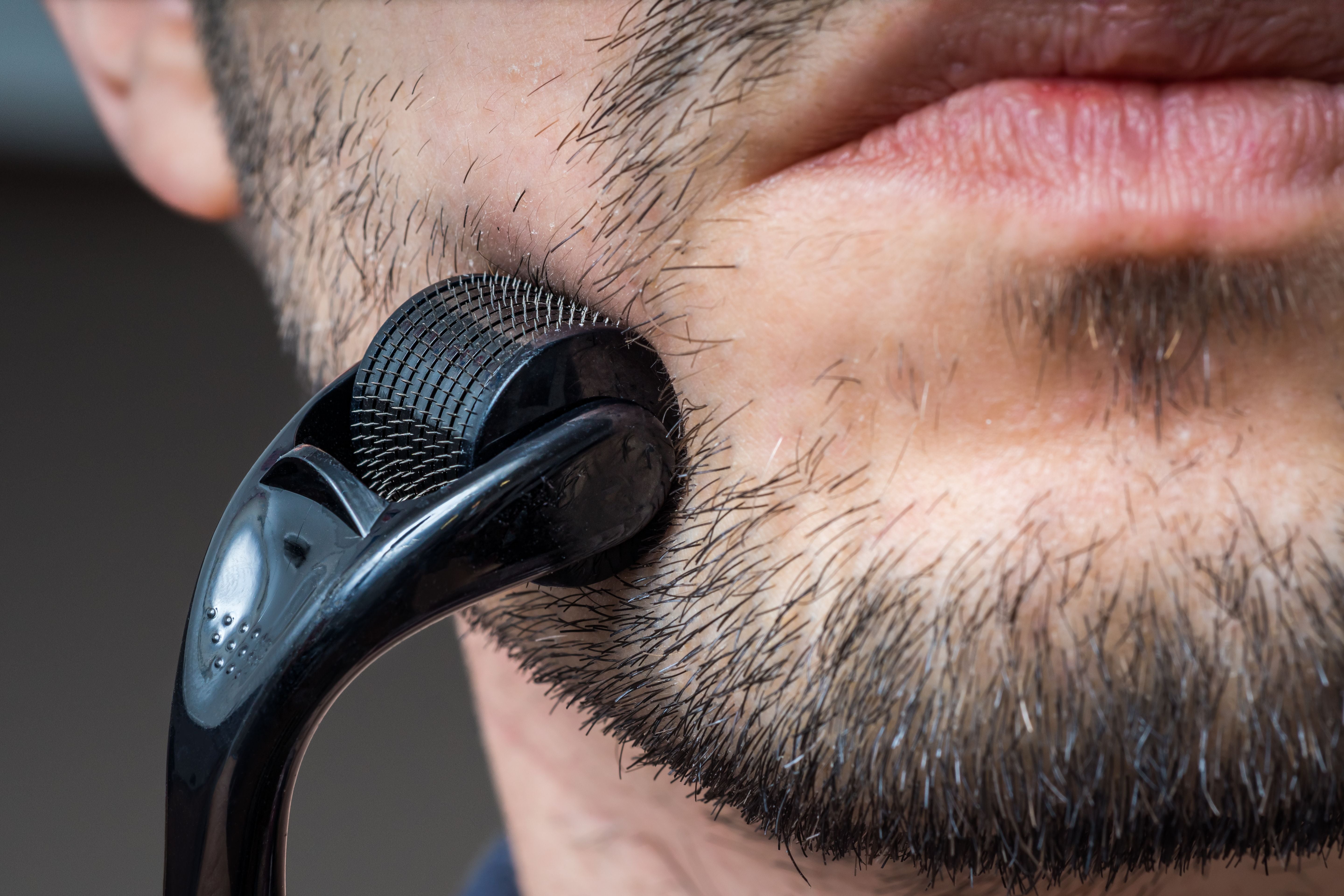 Derma Roller for Beard: What You Need to Know