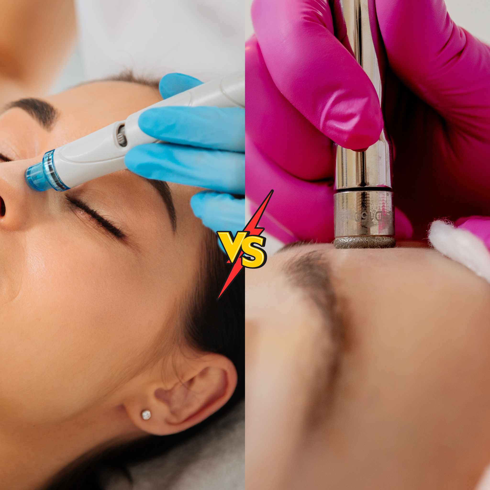 Hydradermabrasion vs Microdermabrasion: A Complete Guide to Your Ideal Facial