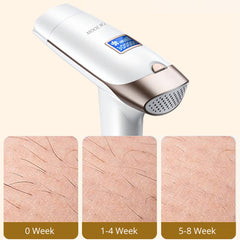 IPL Hair Removal Device With 5 Energy Levels, Large Emission Area for Long-lasting Hair Removal
