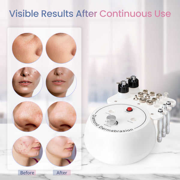 Diamond Microdermabrasion Machine