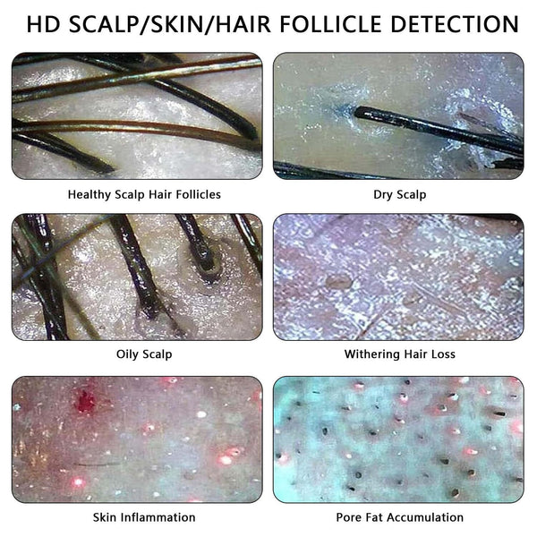 Skin Analyzer Machine