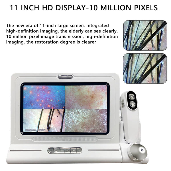 Skin Diagnosis Hair Analyzer