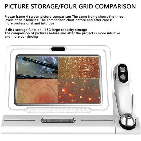 Skin Diagnosis Hair Analyzer