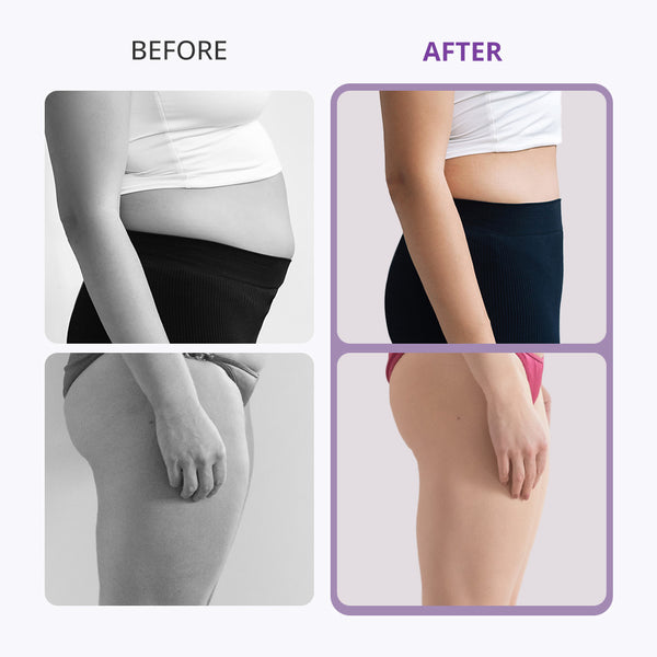 Before and after comparison of a person wearing black compression garments on a white background.
