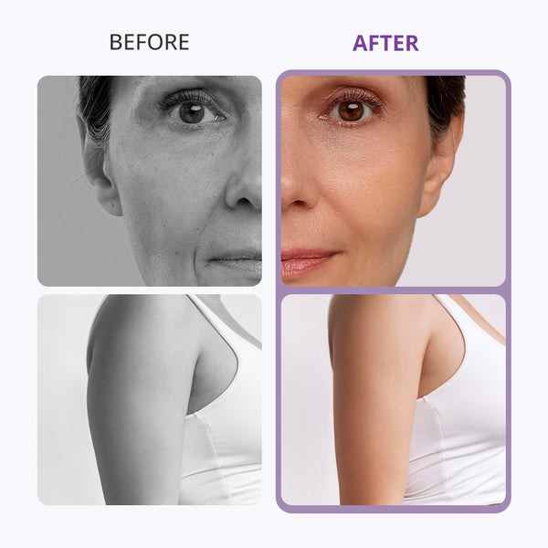 Before and after comparison of a woman's face and arm with visible skin improvement.