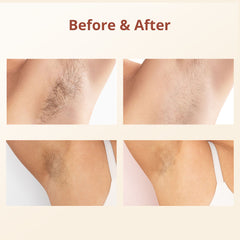 IPL Hair Removal Device With 5 Energy Levels, Large Emission Area for Long-lasting Hair Removal