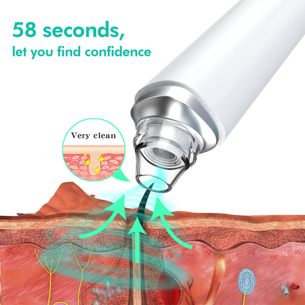 Blackhead Remover Extraction Tool With HD Camera For Visual Blackhead Removal