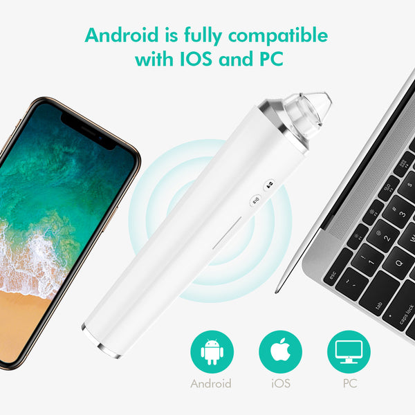 Blackhead Remover Extraction Tool With HD Camera For Visual Blackhead Removal