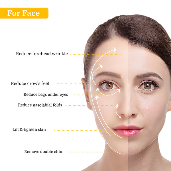 Woman's face with facial treatment lines indicating areas for improvement.