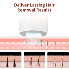 IPL Hair Removal Device With 5 Energy Levels, Large Emission Area for Long-lasting Hair Removal