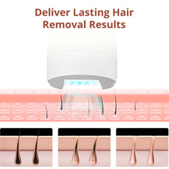 IPL Hair Removal Device With 5 Energy Levels, Large Emission Area for Long-lasting Hair Removal