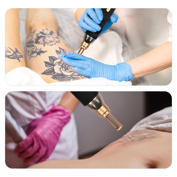 Picosecond Laser Beauty Machine With 3 Laser Head For Tattoo Removal Carbon Facial Peel