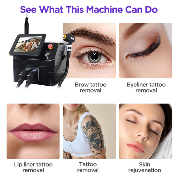 Machine for tattoo and eyeliner removal with before and after images.
