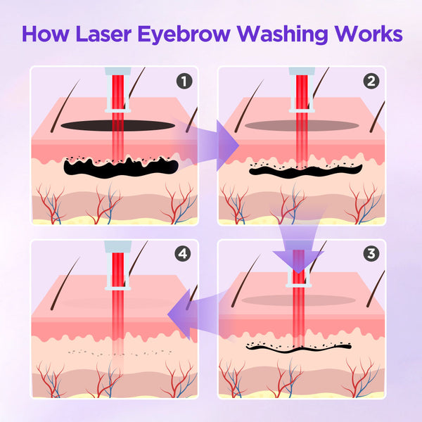 Diagram showing the process of laser eyebrow washing with labeled steps on a purple background.