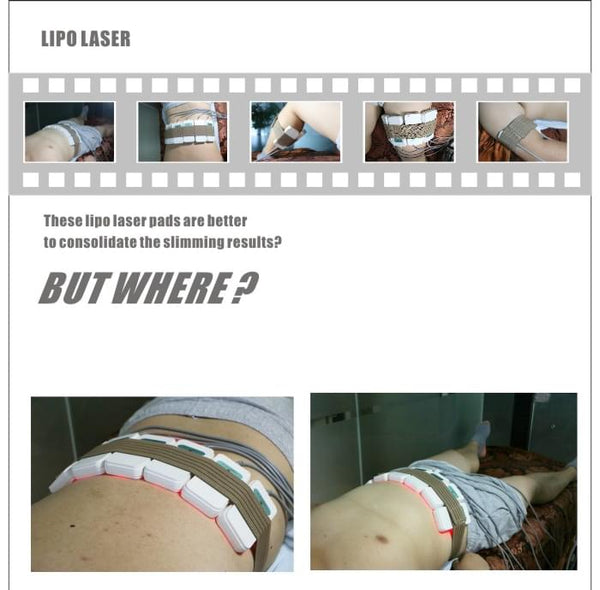 laser lipo pads