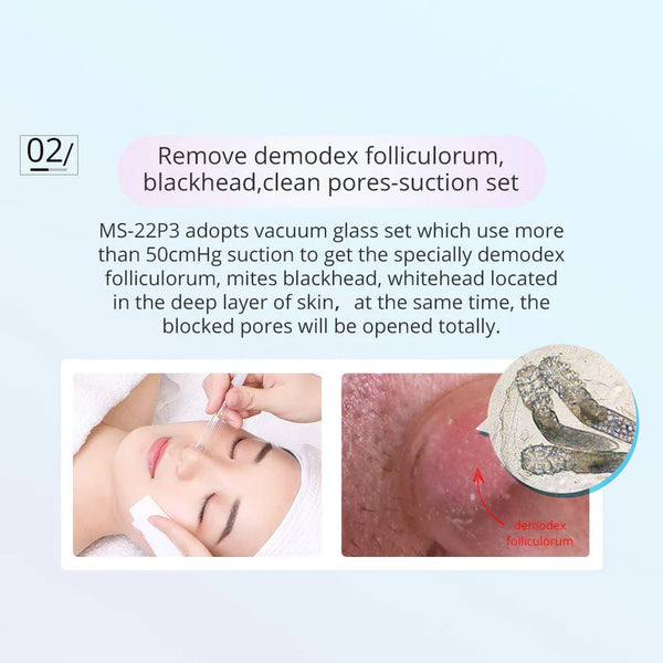 3-In-1 Microdermabrasion Machine