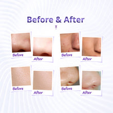 Portable 3 In 1 Diamond Microdermabrasion Machine for Home Use