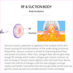 30K 6 In 1 S Shape Cavitation Machine RF&suction handle for body