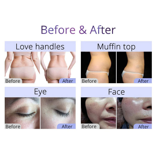 Aristorm 9-In-1 40K Ultrasonic Cavitation Machine For Body Shaping & Facial