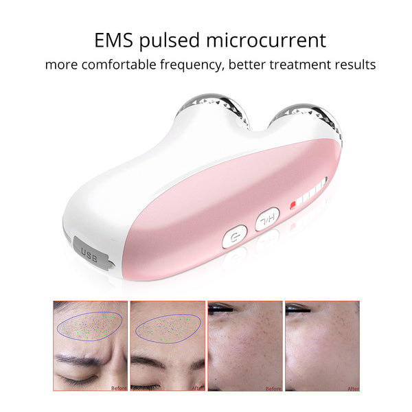 EMS Microcurrent RF Radio Frequency Face Lifting & Wrinkle Removal Beauty Device