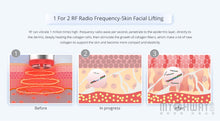 2-1 Mini RF Radio Frequency Photon Facial Wrinkle Removal Antiage Beauty Machine