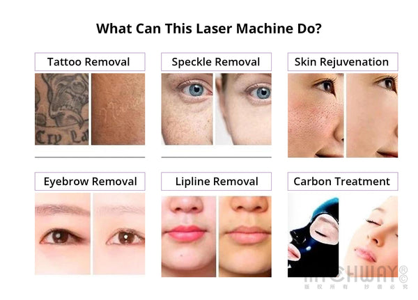Picosecond Laser Machine For Tattoo Spots Removal Skin Whitening Rejuvenation