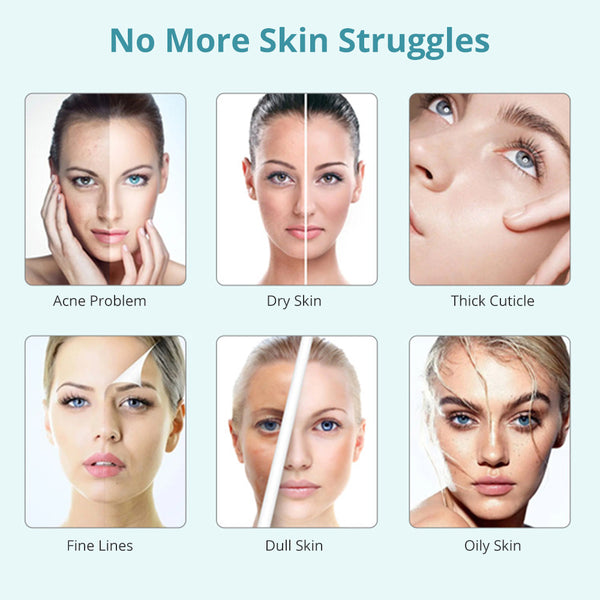 4 In 1 Oxygen Bubble Machine Skin Detection Salon Facial Beauty Machine