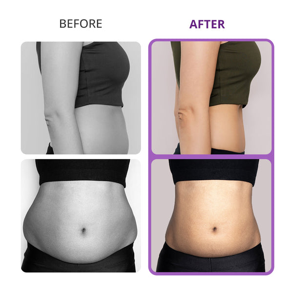 Home Use Cavitation Machine