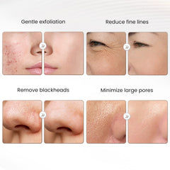 Diamond Microdermabrasion Machine