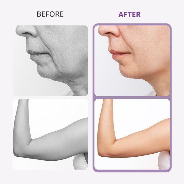 Aristorm 40K Cavitation Machine