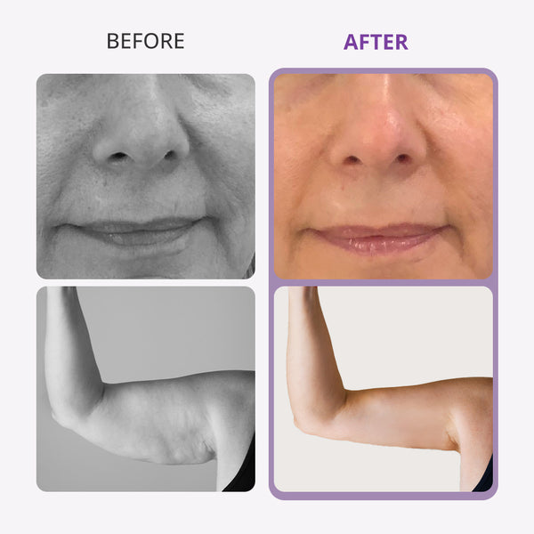 9 in 1 Ultrasonic Cavi Lipo Machine