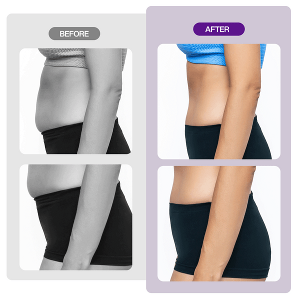 40K Ultrasonic Cavitation Machine