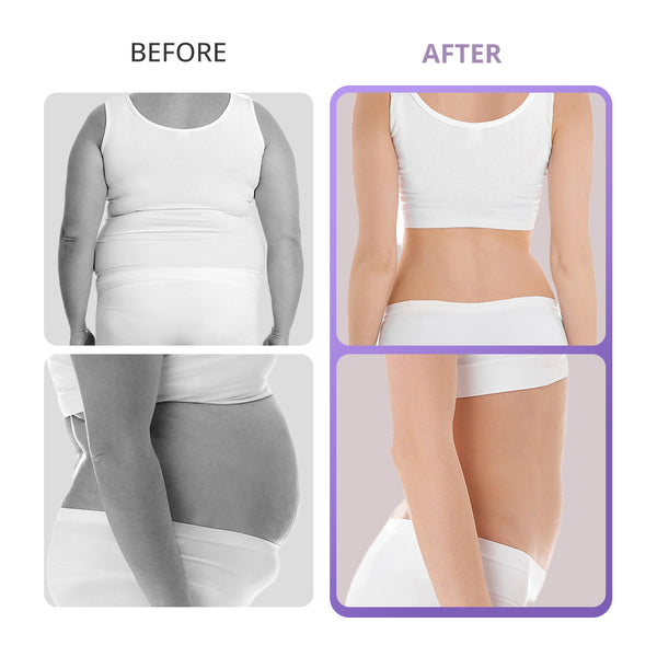 40K Cavitation Machine For Home Use