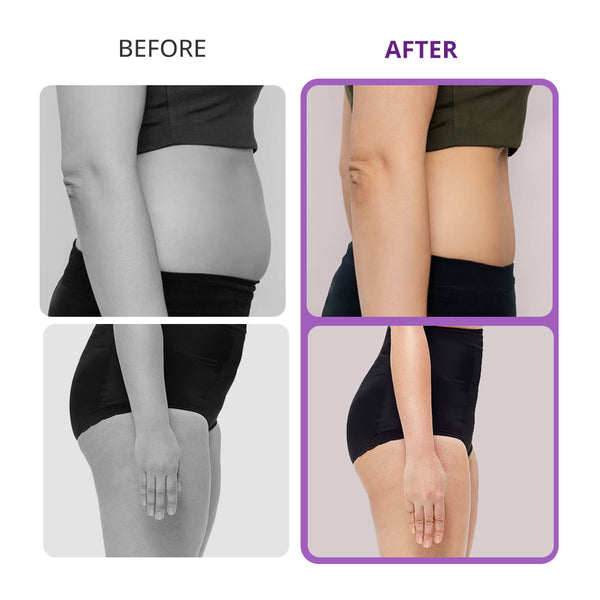 Home Use Cavitation Machine