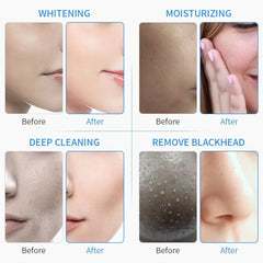 Hydro Dermabrasion Machine