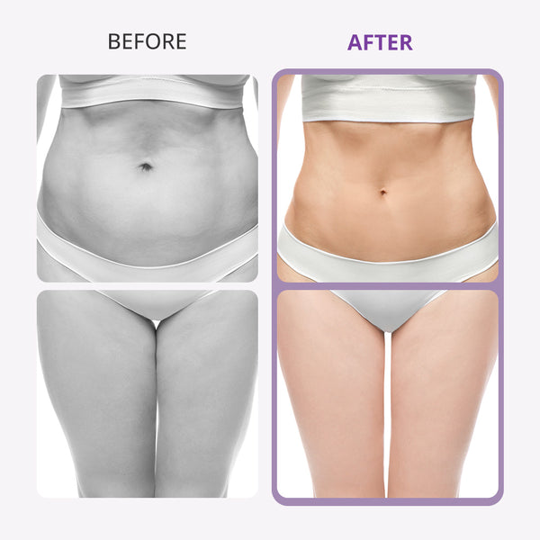 Aristorm 40K Cavitation Machine