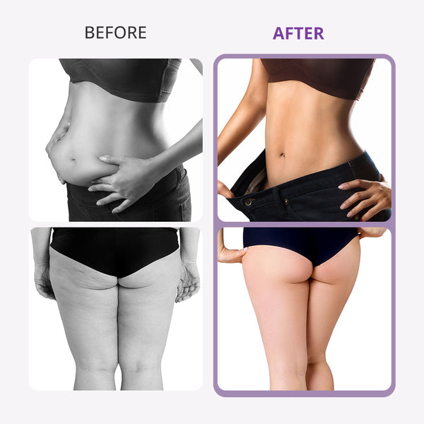 9 in 1 Ultrasonic Cavi Lipo Machine