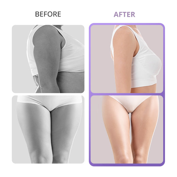 40K Cavitation Machine For Home Use