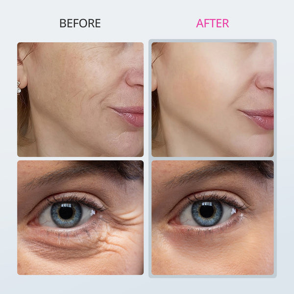 Microcurrent Machine