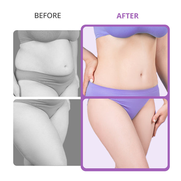 40k Cavitation Machine