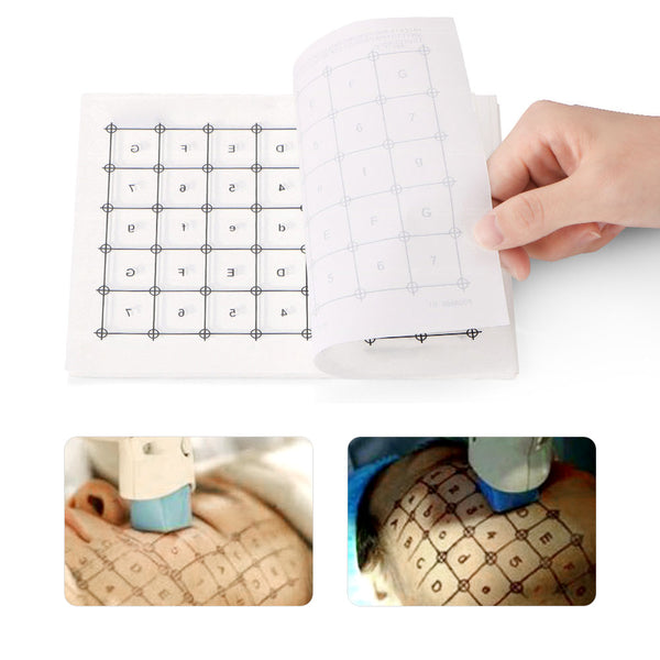 Skin Marking Paper for Fractional RF Machines