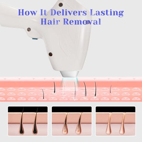 2 In1 DPT 808nm Diode Hair Removal YAG Laser Tattoo Removal Machine