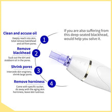 Portable Diamond Dermabrasion Machines Surebeauty