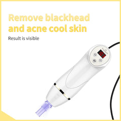 Portable Diamond Dermabrasion Machines Surebeauty