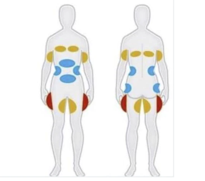 Cryolipolysis Handle With 3 Size