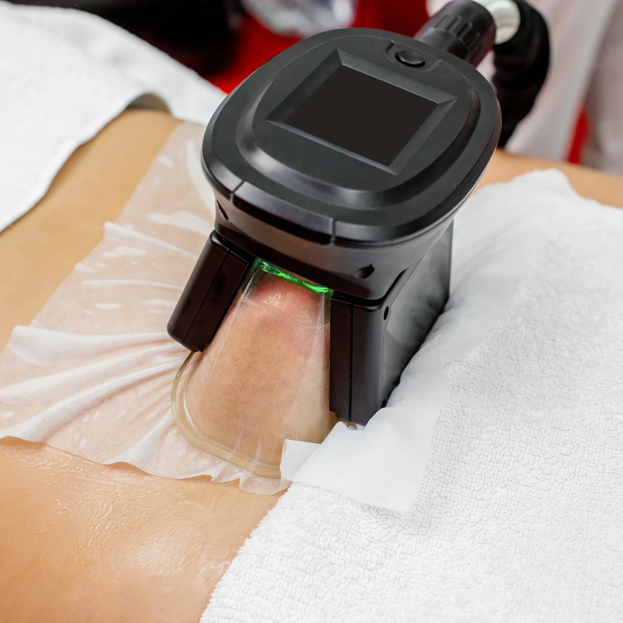 How To Speed Up Healing From Cryotherapy