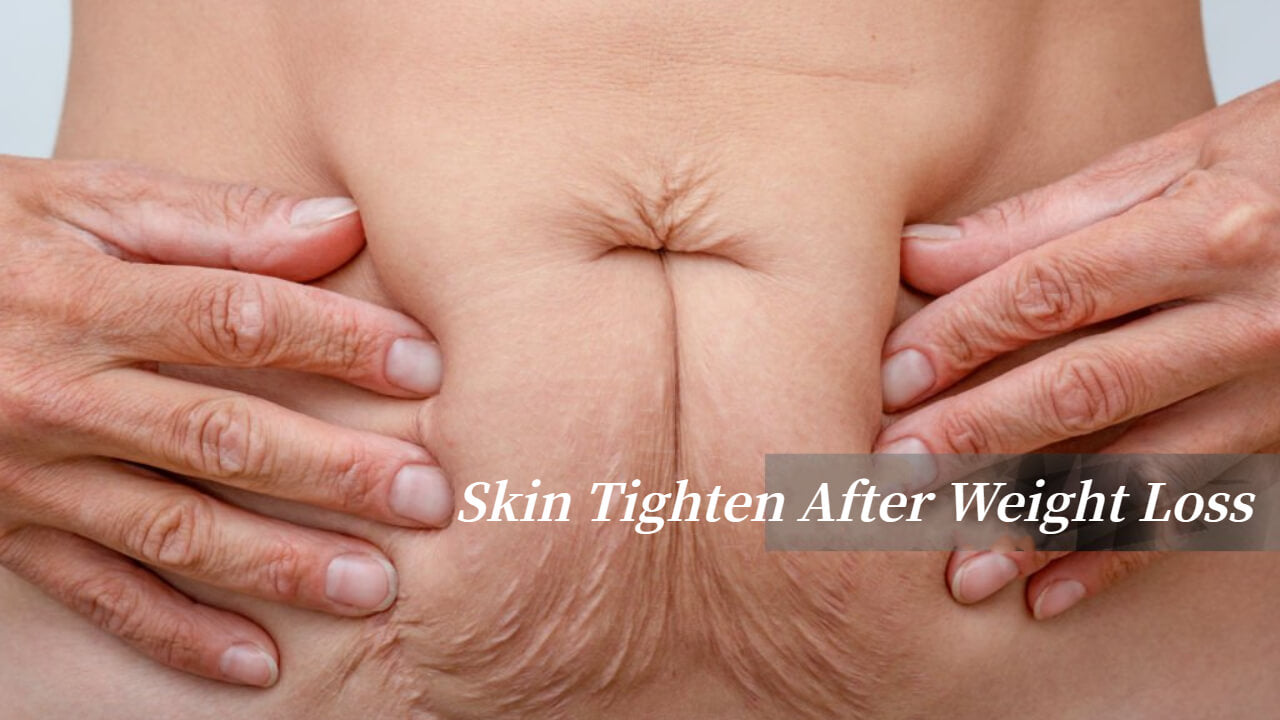 How To Tighten Loose Skin After Gastric Bypass Without Surgery
