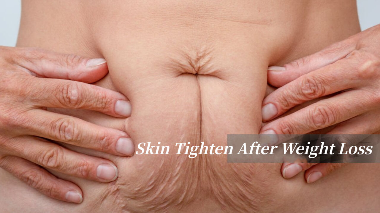 How To Tighten Skin After Weight Loss