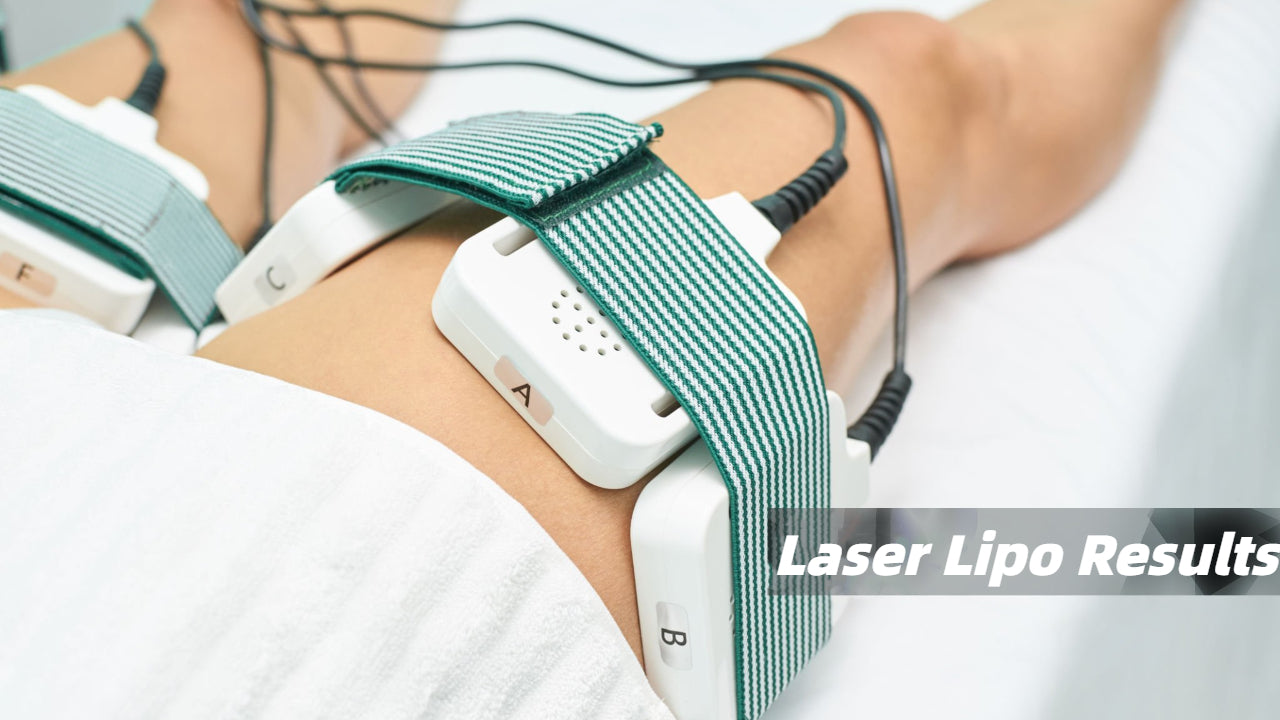 Unveiling the Truth: What to Expect from Laser Lipo Results