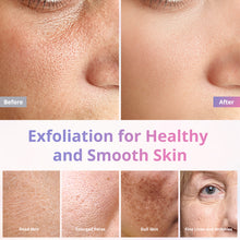 Diamond Microdermabrasion Machine